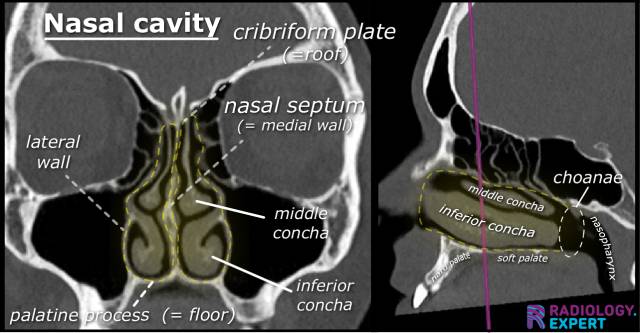 Nasal Bone Anatomy Ct The Facial Mid Sagittal Computed Tomography Scan